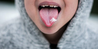 Bílý povlak na jazyku: Co může signalizovat a jak se ho zbavit přírodní cestou?