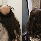 hairspec